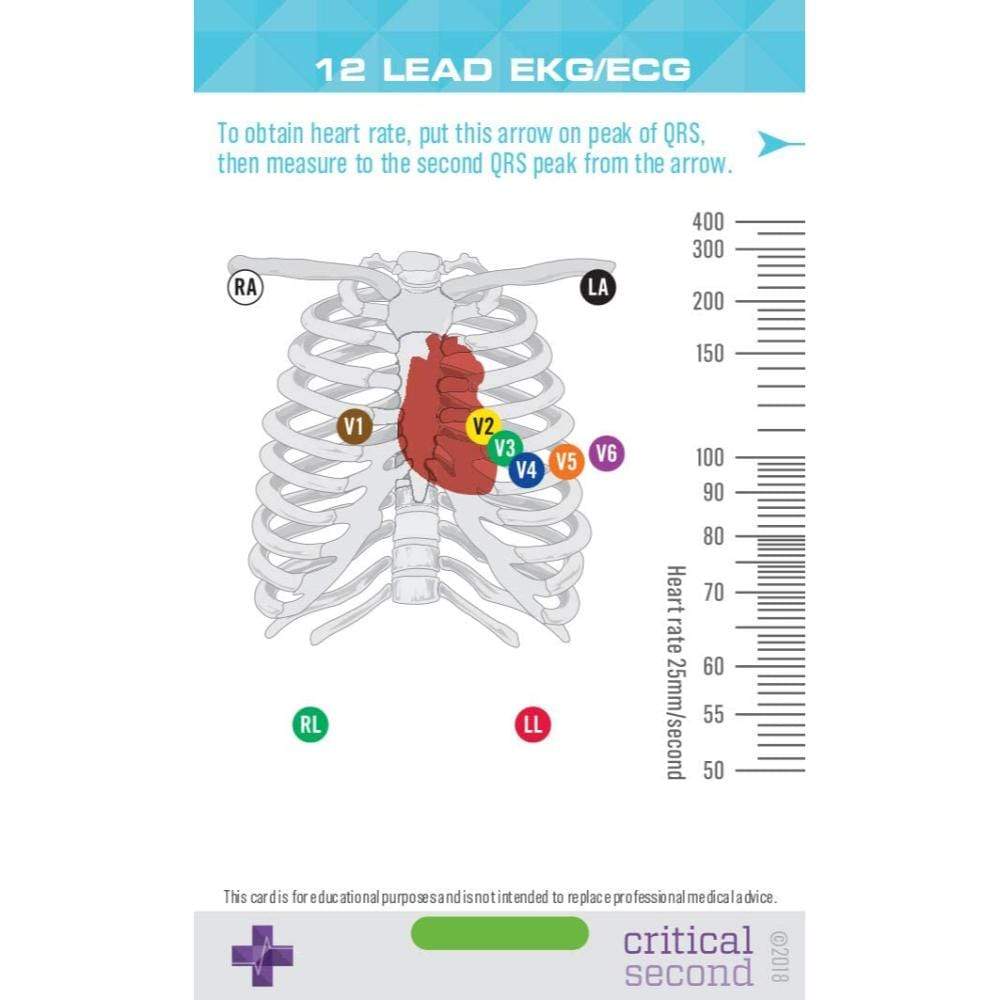 EKG Educational Cards