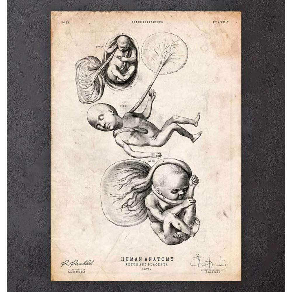 Fetus In A Womb Anatomy Print III